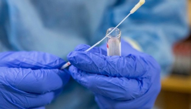 Коронавірус на Закарпатті: діагностовано 38 нових випадків