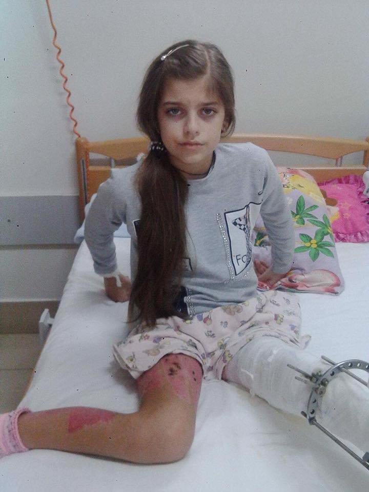 Покалічена недбалістю: юна ужгородка перенесла вже 28 опера..., фото-1 Покалічена недбалістю: юна ужгородка перенесла вже 28 операцій, а винуватців її каліцтва досі не покарано (ВІДЕО), фото-1