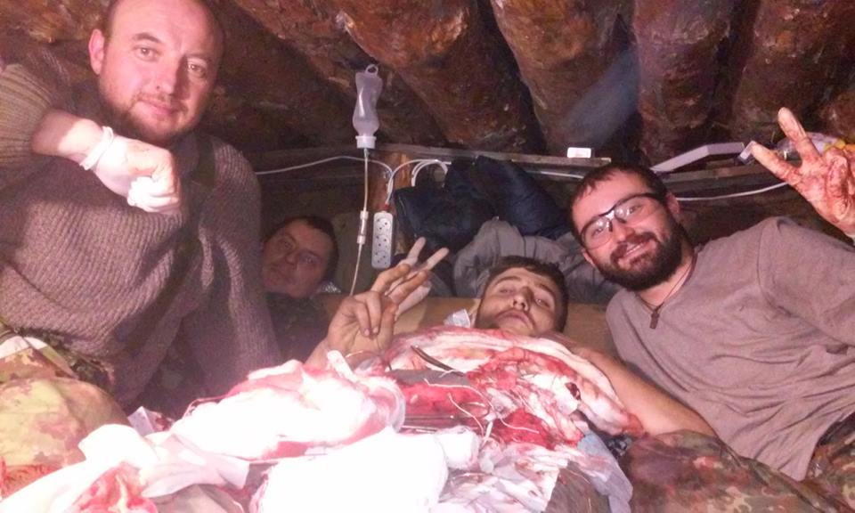 95 операцій в бліндажі за 9 діб: спогади легендарного війсь..., фото-2 95 операцій в бліндажі за 9 діб: спогади легендарного військового хірурга із Закарпаття Олександра Данилюка (ФОТО), фото-2