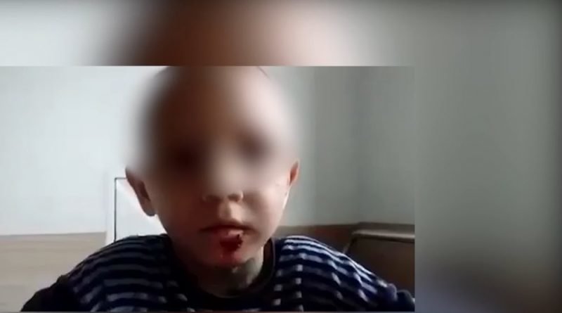 Ужгородка, яка жорстоко катувала всиновленого сина, вимагає..., фото-1 Ужгородка, яка жорстоко катувала всиновленого сина, вимагає в суді зняти із себе всі обвинувачення (ВІДЕО), фото-1